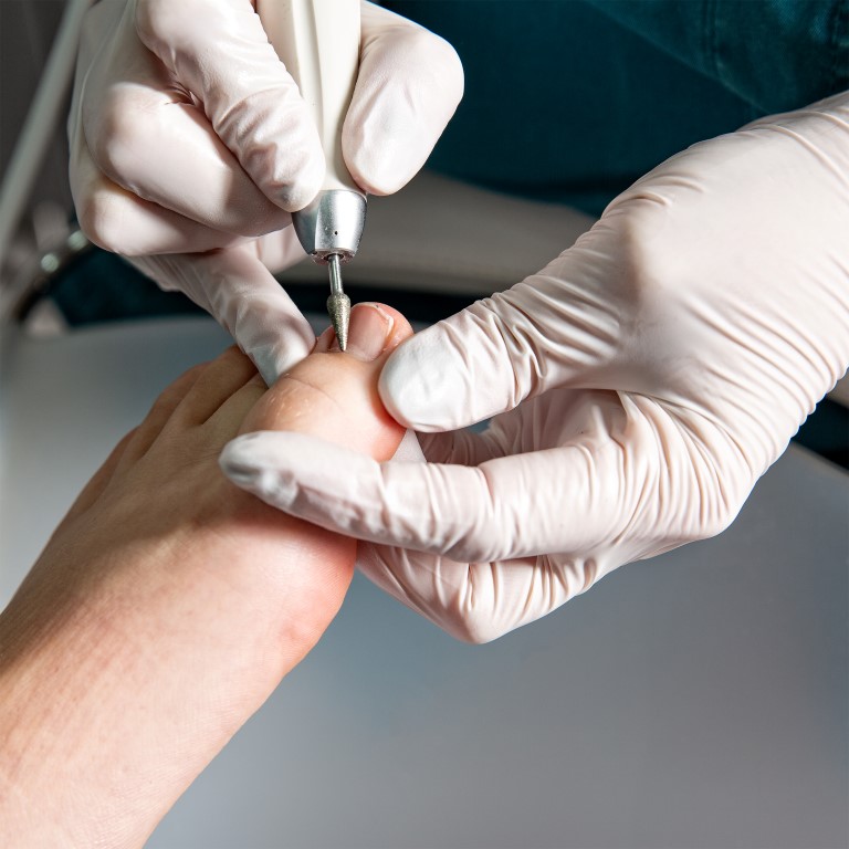 Risicovoeten bij diabetes & reuma