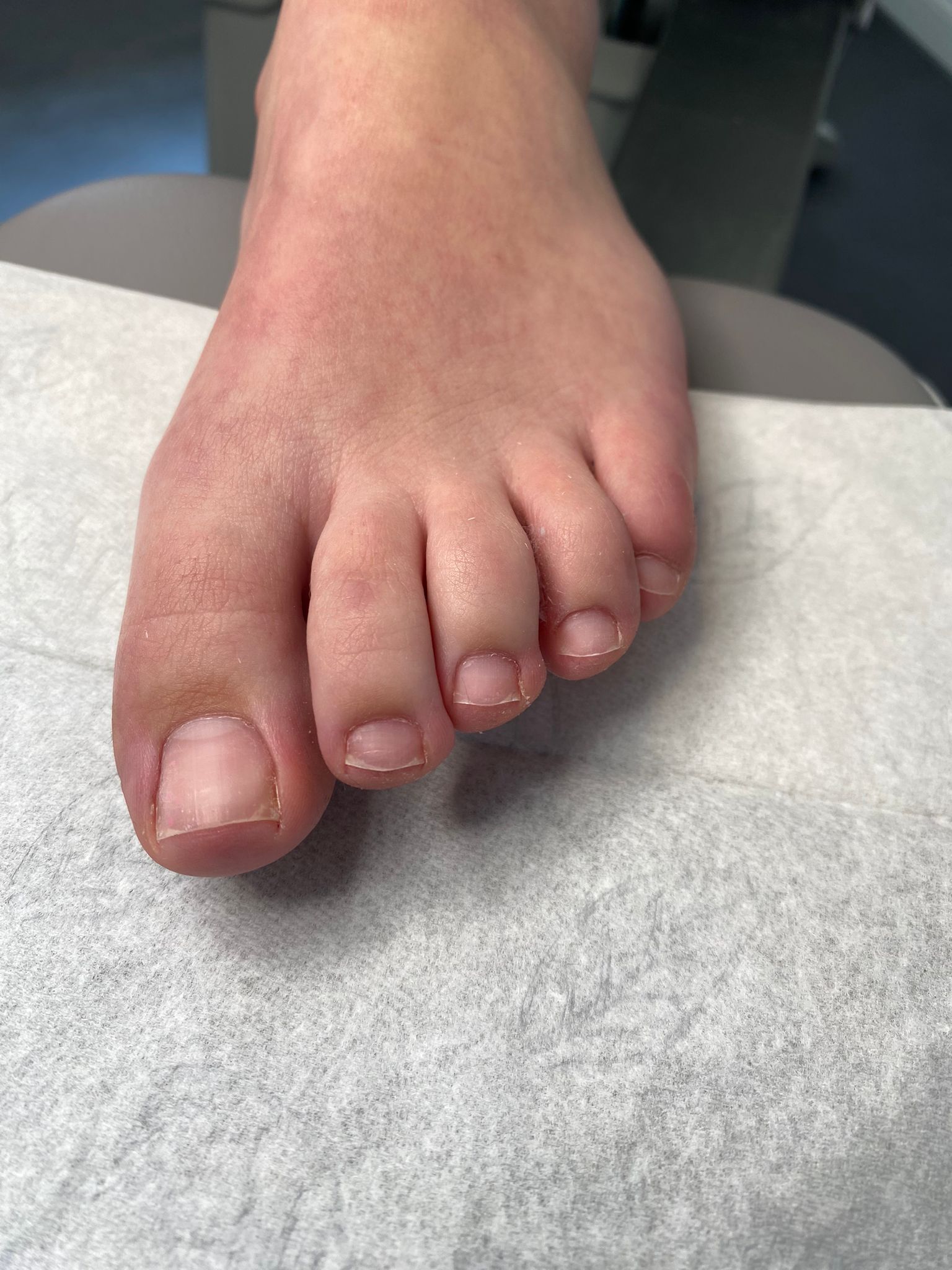 Gellak Teennagels